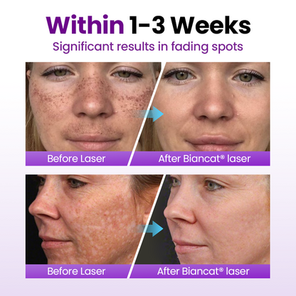 Sylvancove® SpotErase Probiotic Shield Serum