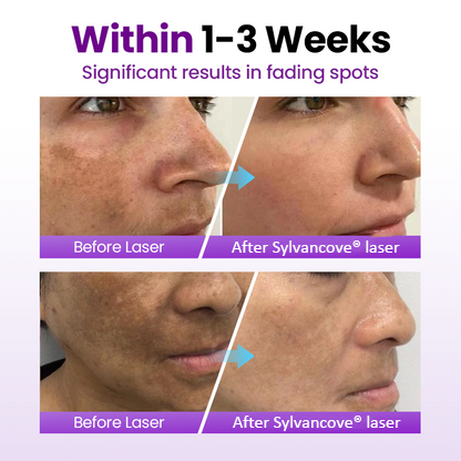 Sylvancove® SpotErase Probiotic Shield Serum