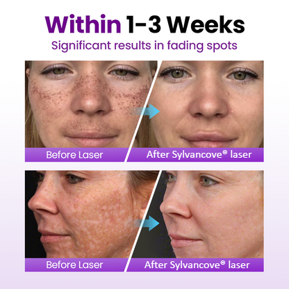 Sylvancove® SpotErase Probiotic Shield Serum