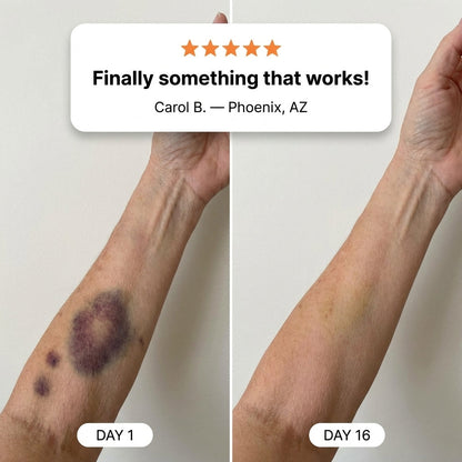 💥75K+ SOLD💕- Sylvancove™ Bruise Repair & Skin-Strengthening Cream