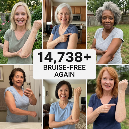 💥75K+ SOLD💕- Sylvancove™ Bruise Repair & Skin-Strengthening Cream
